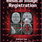 Medical Image Registration