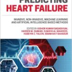 Predicting Heart Failure